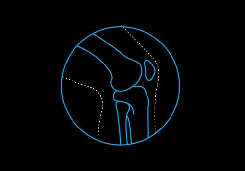 PREVENCIÓN DE LESIONES